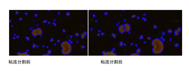 粘連分割.jpg